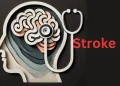 brain-affected-by-stroke