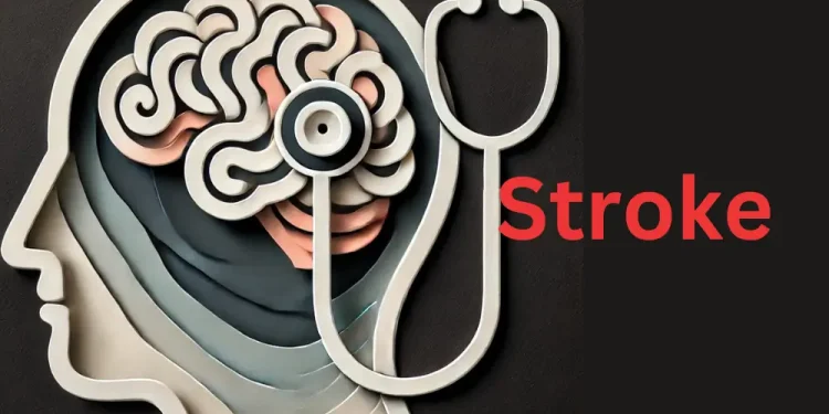 brain-affected-by-stroke