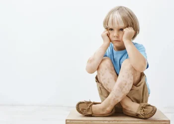 Child-with-Kawasaki-Disease