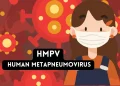 Human-Metapneumovirus